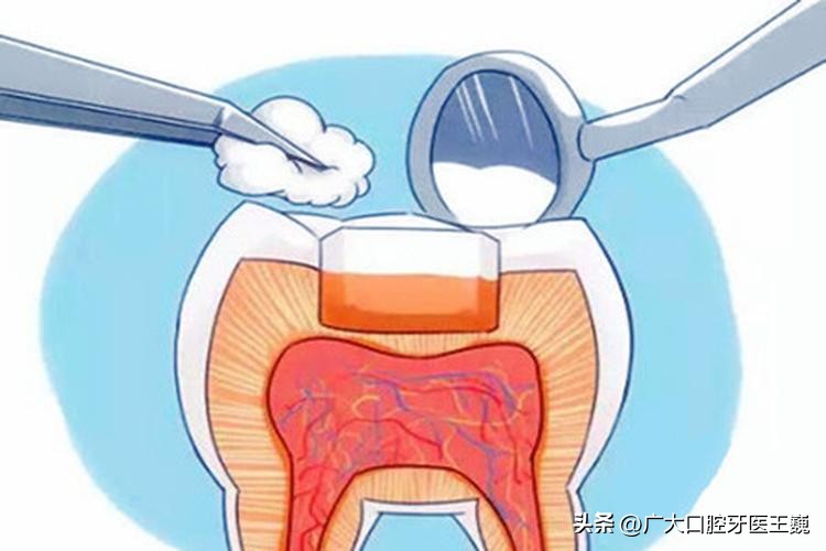 口腔科普缺牙而已真的这么可怕吗,口腔科普讲解牙齿缺失