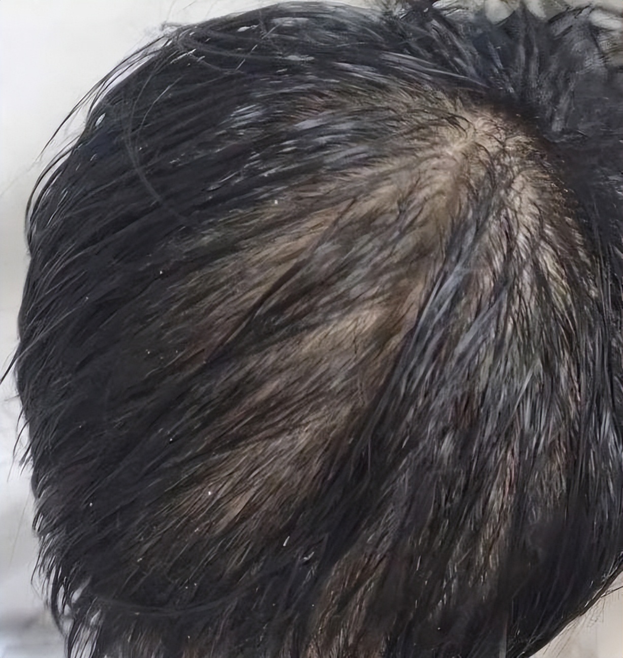 生发液便宜好货推荐,生发液停掉不掉发推荐