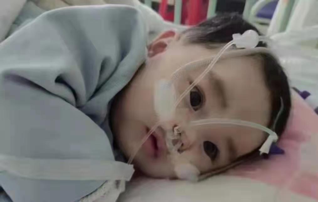 罕见病sma报销比例,罕见病sma可以完全康复吗