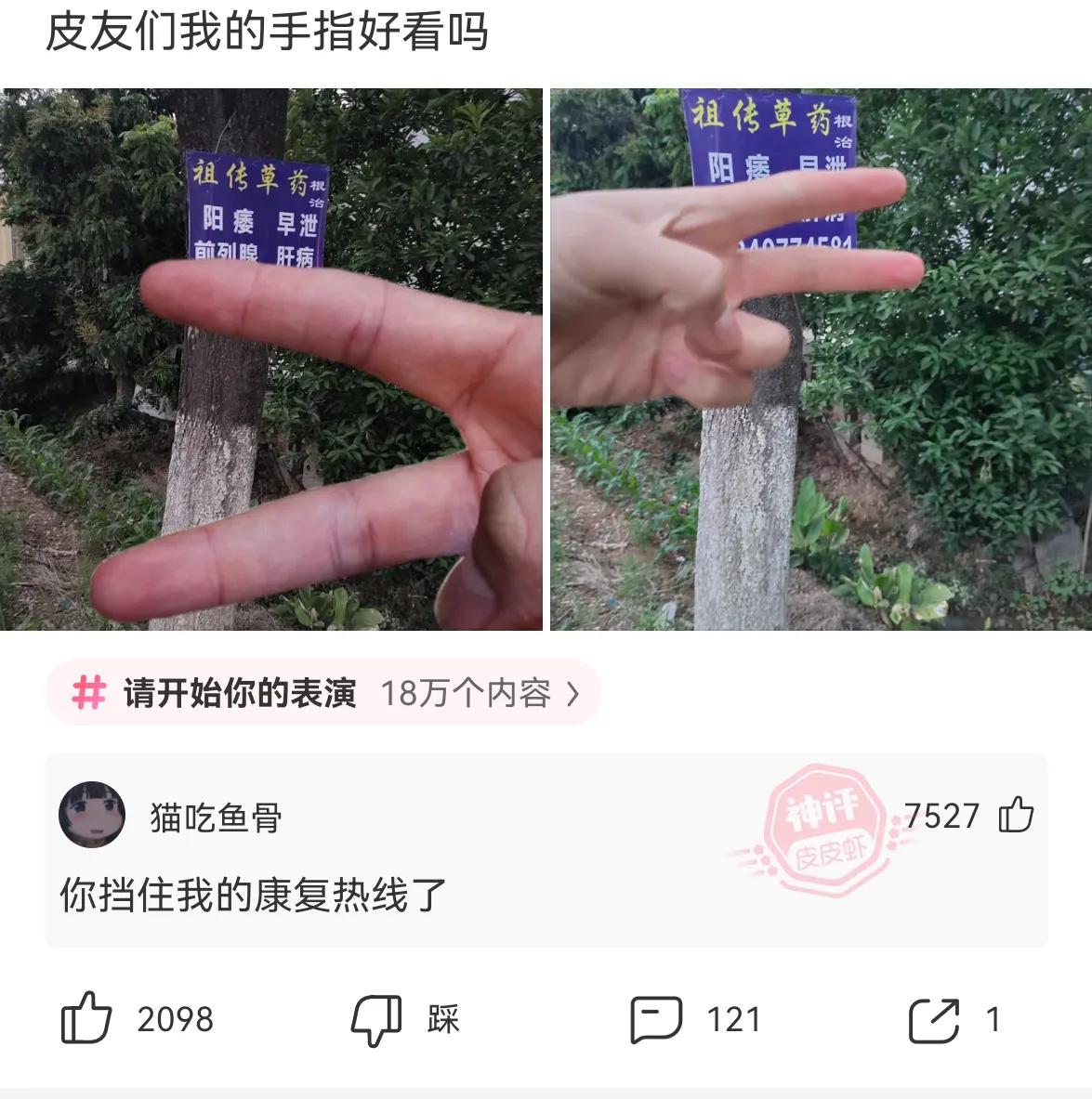 神回复：你是不是捡别人手机了