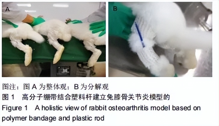 高分子矫形合成绷带,高分子石膏绷带治疗膝过伸