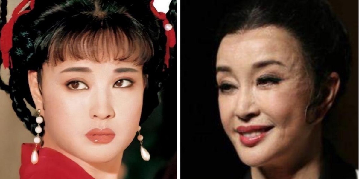 明星下颚骨整容后遗症,脸像鞋拔子怎么改善