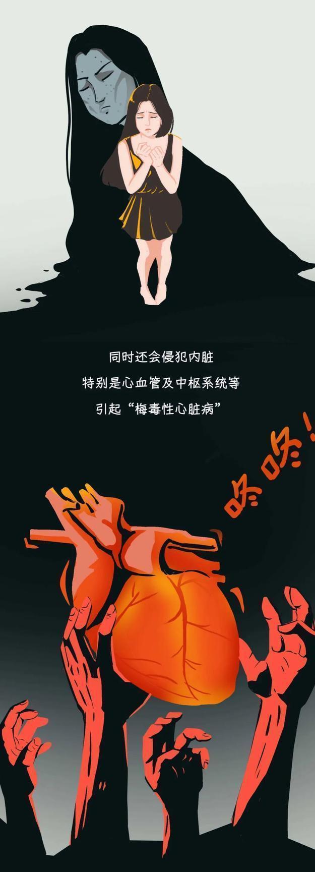 了解梅毒,了解一下梅毒病的形成与治疗