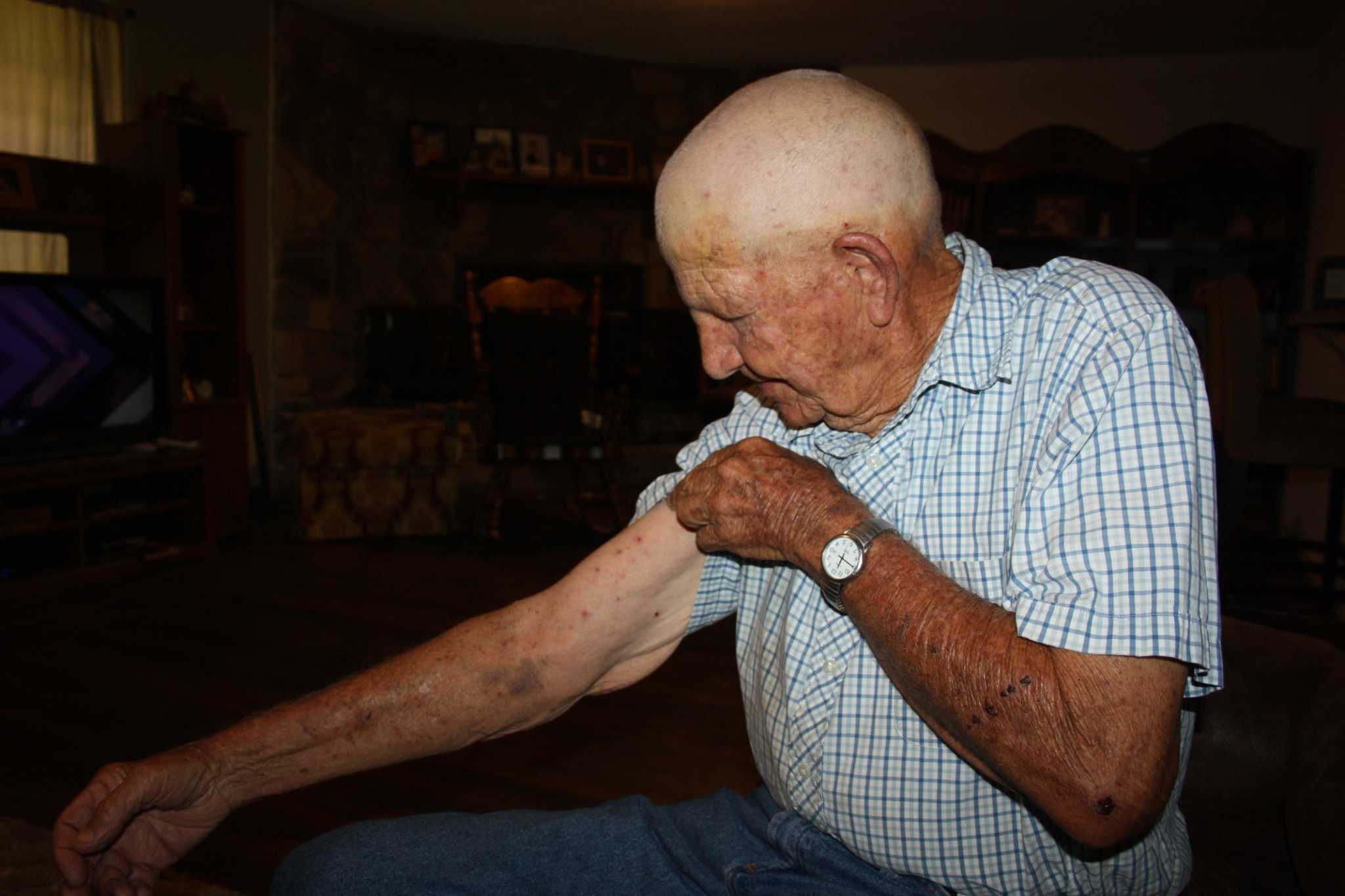 假如你被这么多蜜蜂蛰了怎么办呢,你敢相信被蜜蜂活活蛰死吗