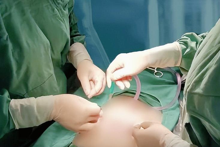 老婆子宫切了怎么办,子宫肌瘤把子宫全切了很后悔