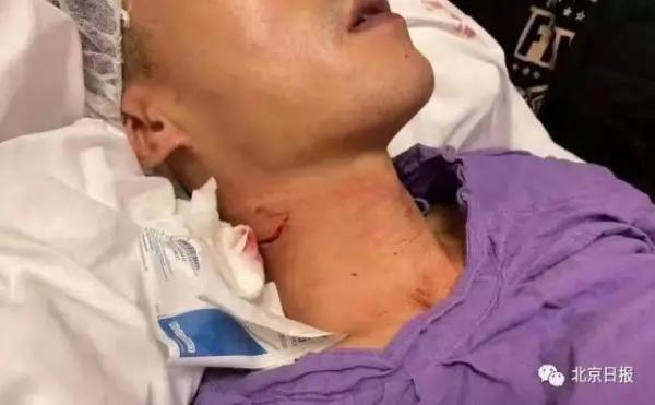 割伤港警颈部的暴徒，判了