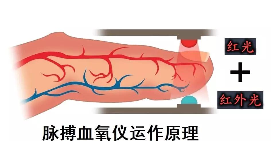 血氧仪被疯抢，它怎么能测出血氧浓度？智能手表或手环能代替吗？