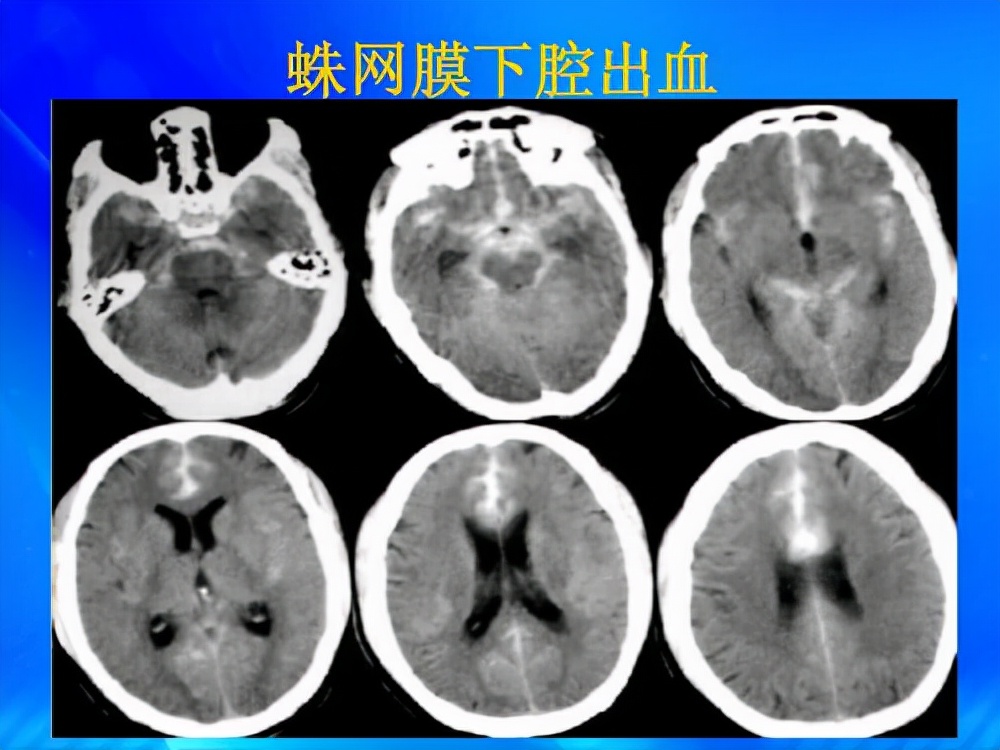 世上最痛苦的三种酷刑,世上最痛的5种病