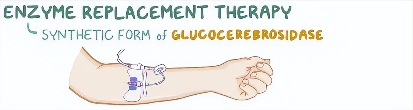 戈谢病纳入医保,戈谢病纳入医保后续