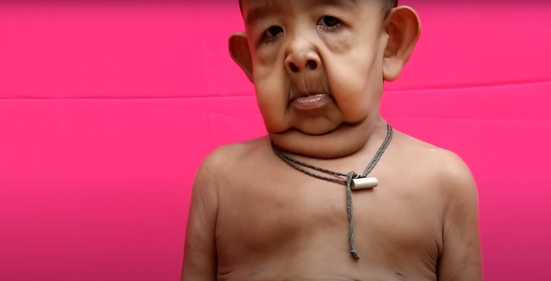 10个难以置信的人类，树皮人、外星人、拥有粗壮手臂的大力水手