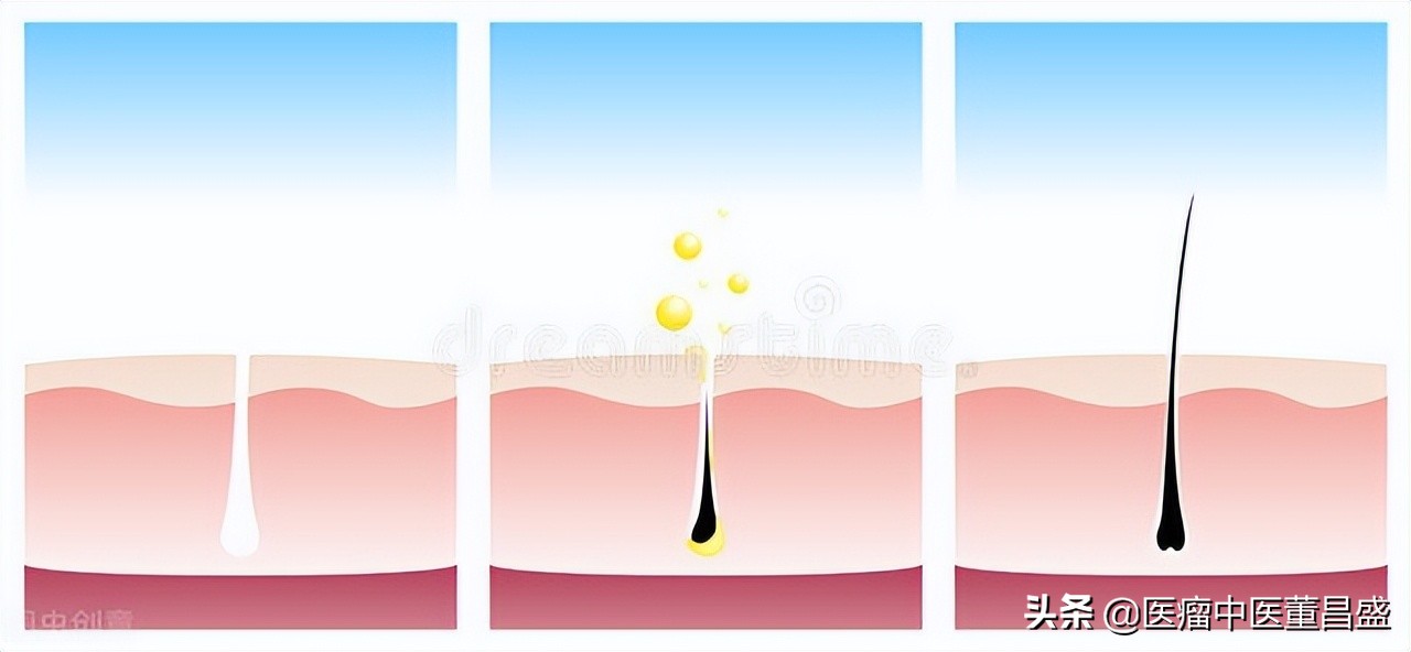 生发养发治疗各种脱发奇效,生发乌发中药材