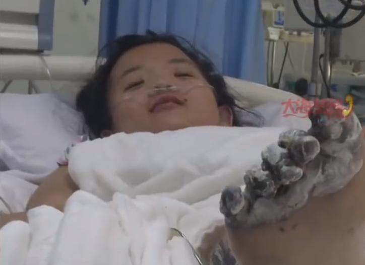 苹果充电被电截肢,苹果手机充电被电击事件