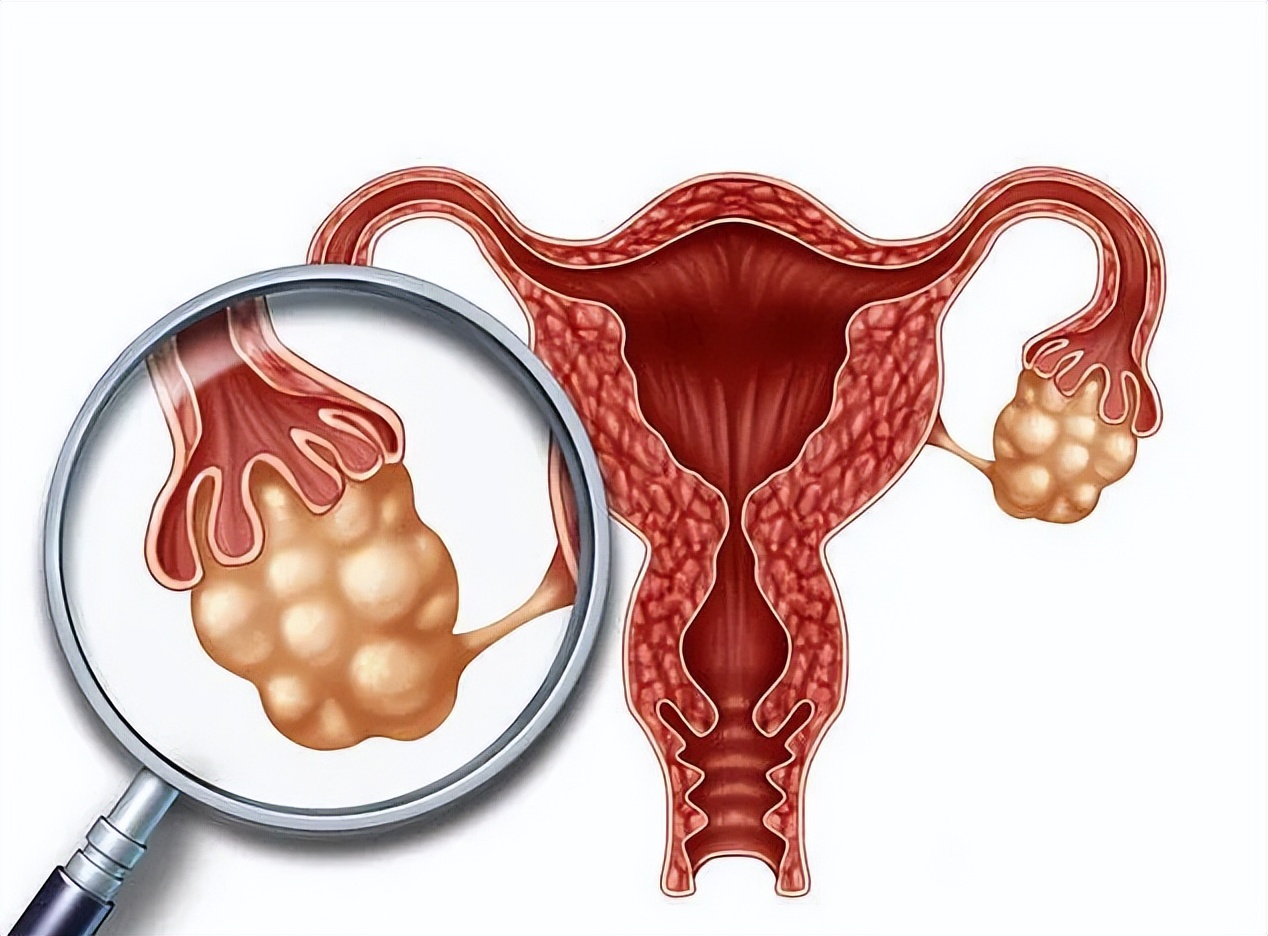 petct对各类肿瘤诊断的准确率,已确诊宫颈癌还有必要做petct吗
