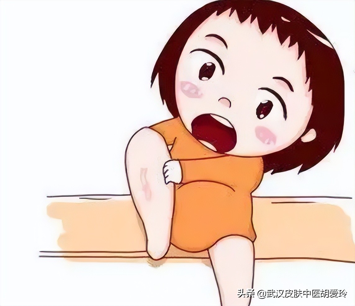 腿上一片硬硬的特别痒,在三亚腿上起疙瘩很硬特别痒