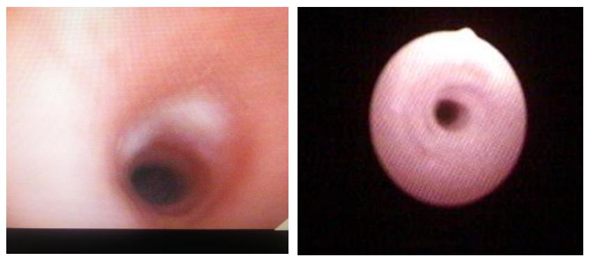 徐州市儿童医院呼吸二科,儿童呼吸介入科的设备