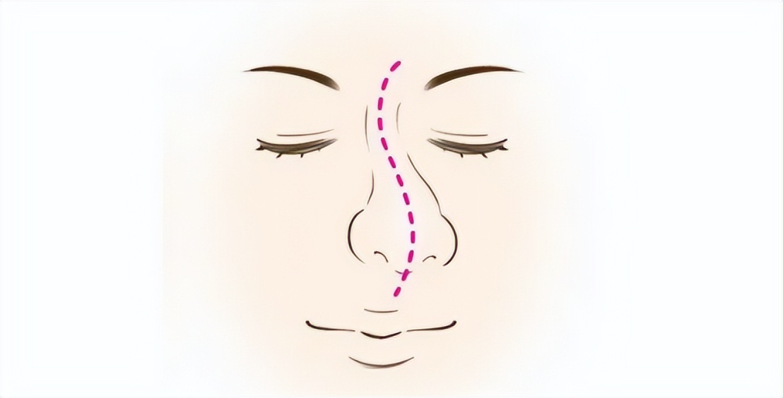 陈国成最近视频,陈国成视频