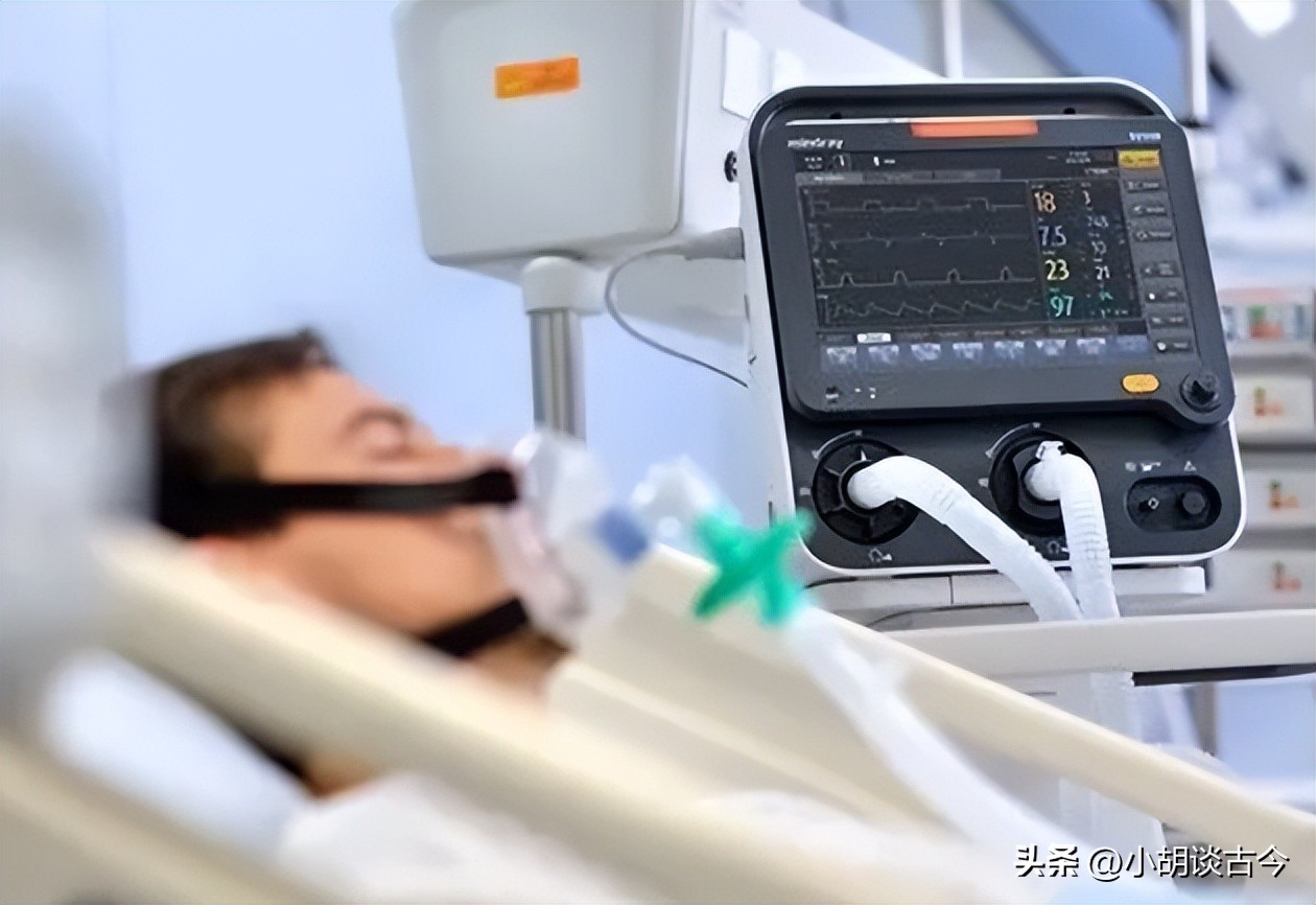 四川父亲忍痛拔掉儿子呼吸机,家人拔掉呼吸机视频