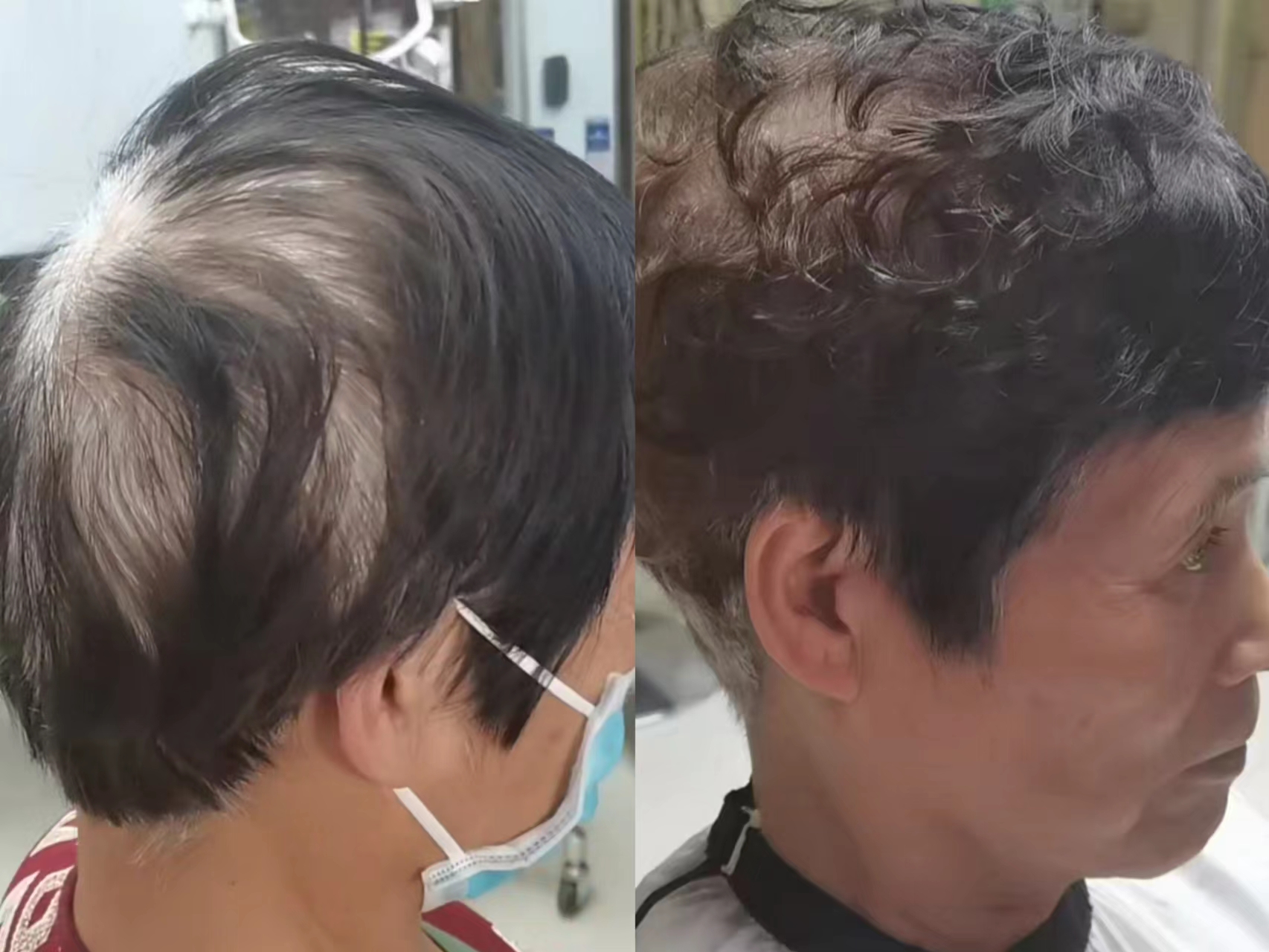 老年人白发烫什么发型好,老人冷烫满头卷短发发型