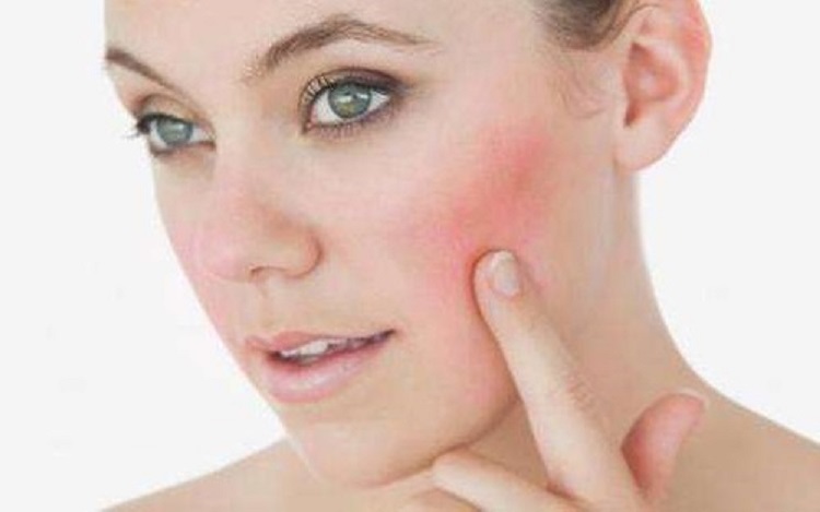 皮肤泛红敏感肌肤多久能调理好,泛红干燥敏感肌护肤