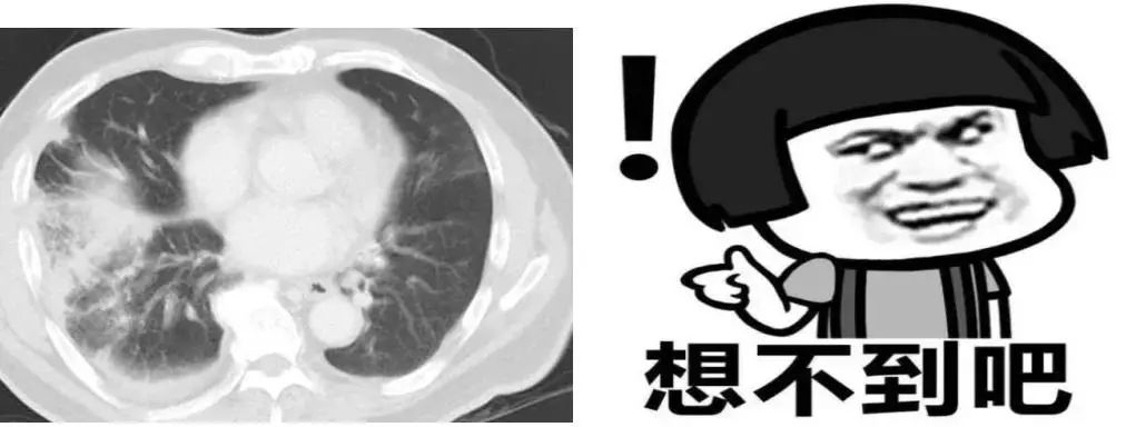 喉管长了一个包怎么办,气管里总长痰栓怎么治疗