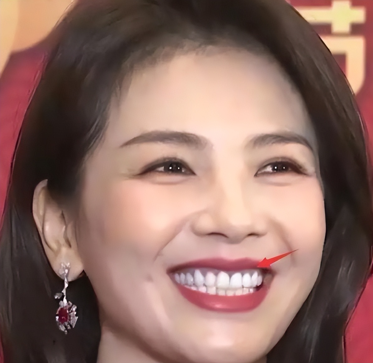 娱乐圈女星龅牙露一颗牙,娱乐圈的假牙女星