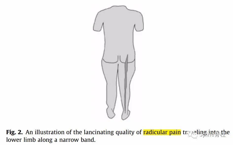 腰椎间盘突出症状表现,腰椎间盘突出症疼痛最佳止痛方法