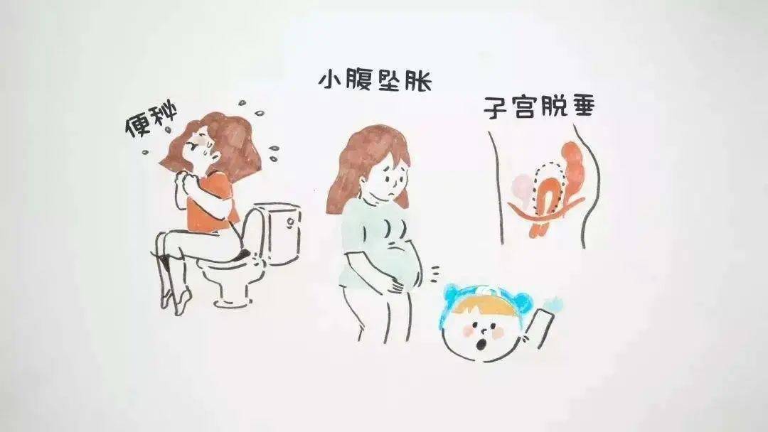 女性六十岁子宫脱垂怎么治疗,子宫脱垂一级的女性多吗