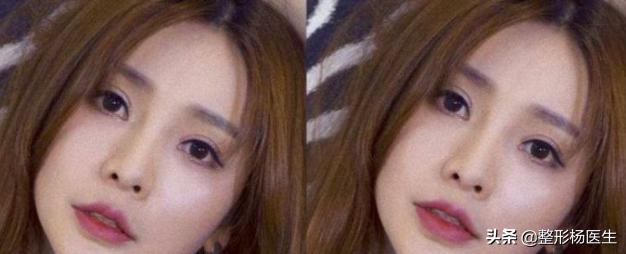 人中太长了好看吗,人中太长显老怎么办