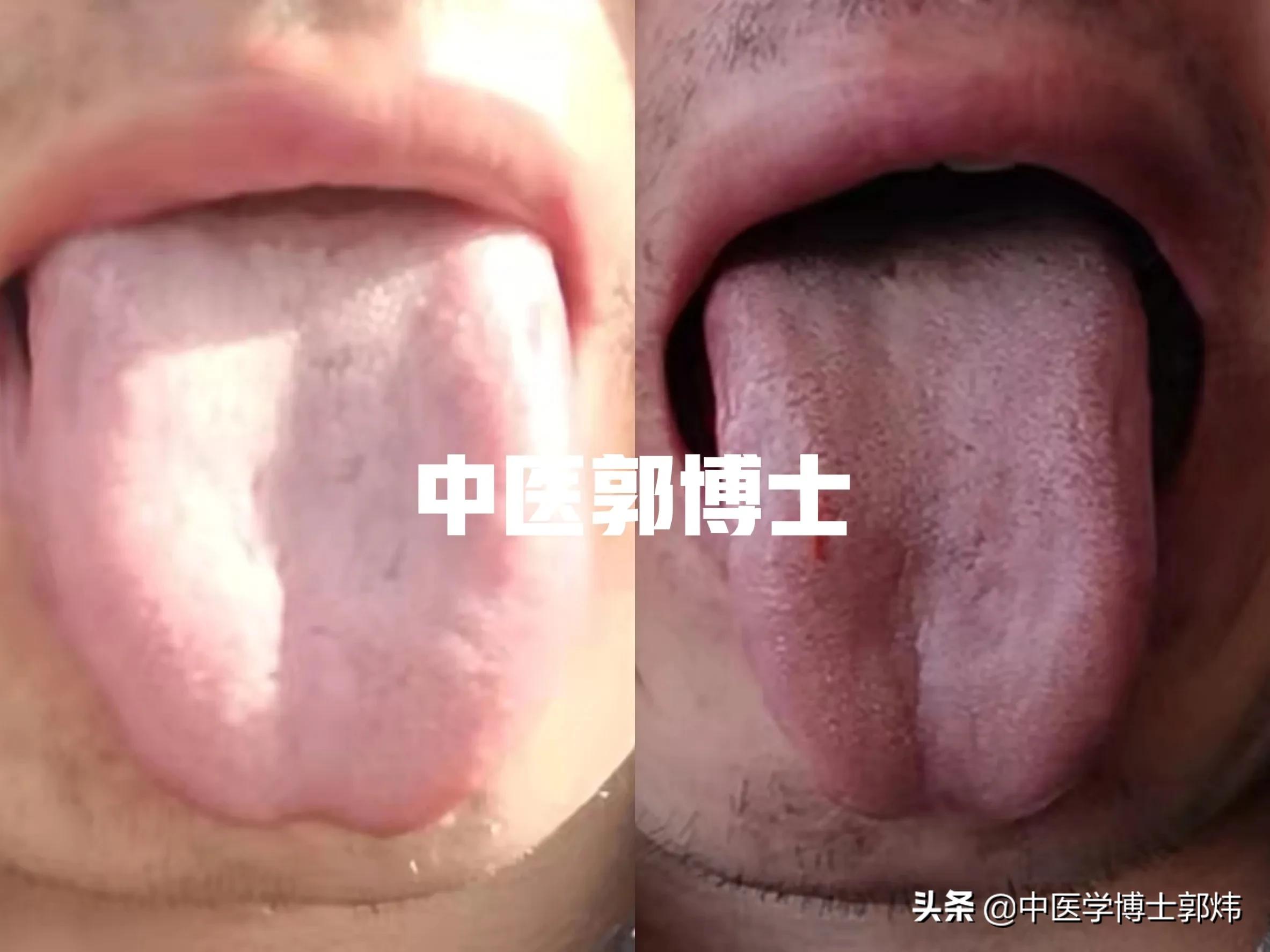 血虚头晕喝中药多久能恢复,贫血补血后的头晕多久能恢复