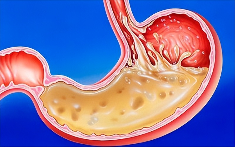 木香顺气丸治胃凉吗,胃气不舒吃木香顺气丸管用吗