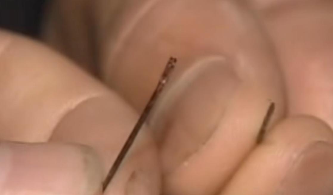 24岁小伙子被怪病缠身15年,24岁小伙被怪病缠身十五年