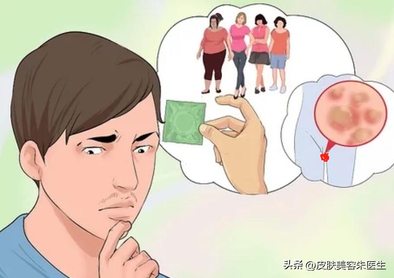 担心自己有尖锐性湿疣,预防尖锐性湿疣的注意事项