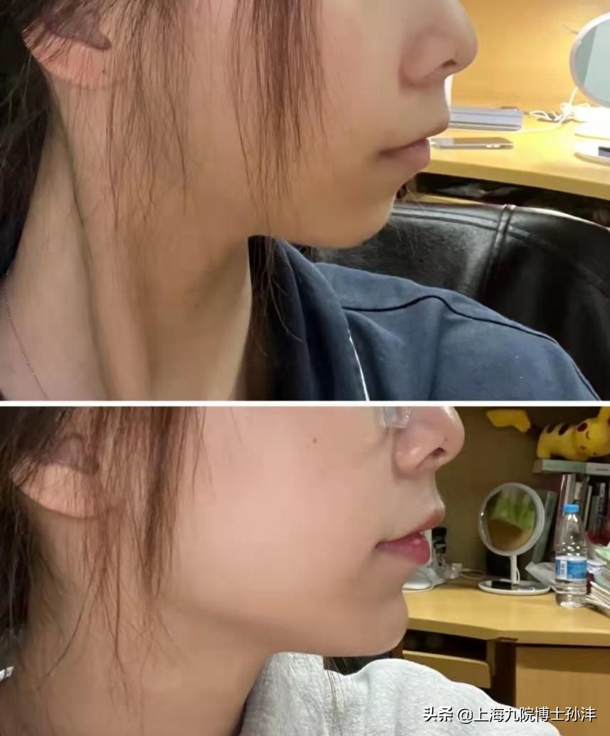 下巴对气质的影响,最好的下巴是双下巴吗