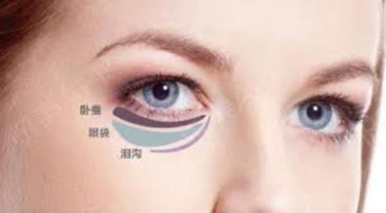 卧蚕眼袋大最简单的去眼袋的方法,消除眼袋方法多勿把卧蚕当眼袋