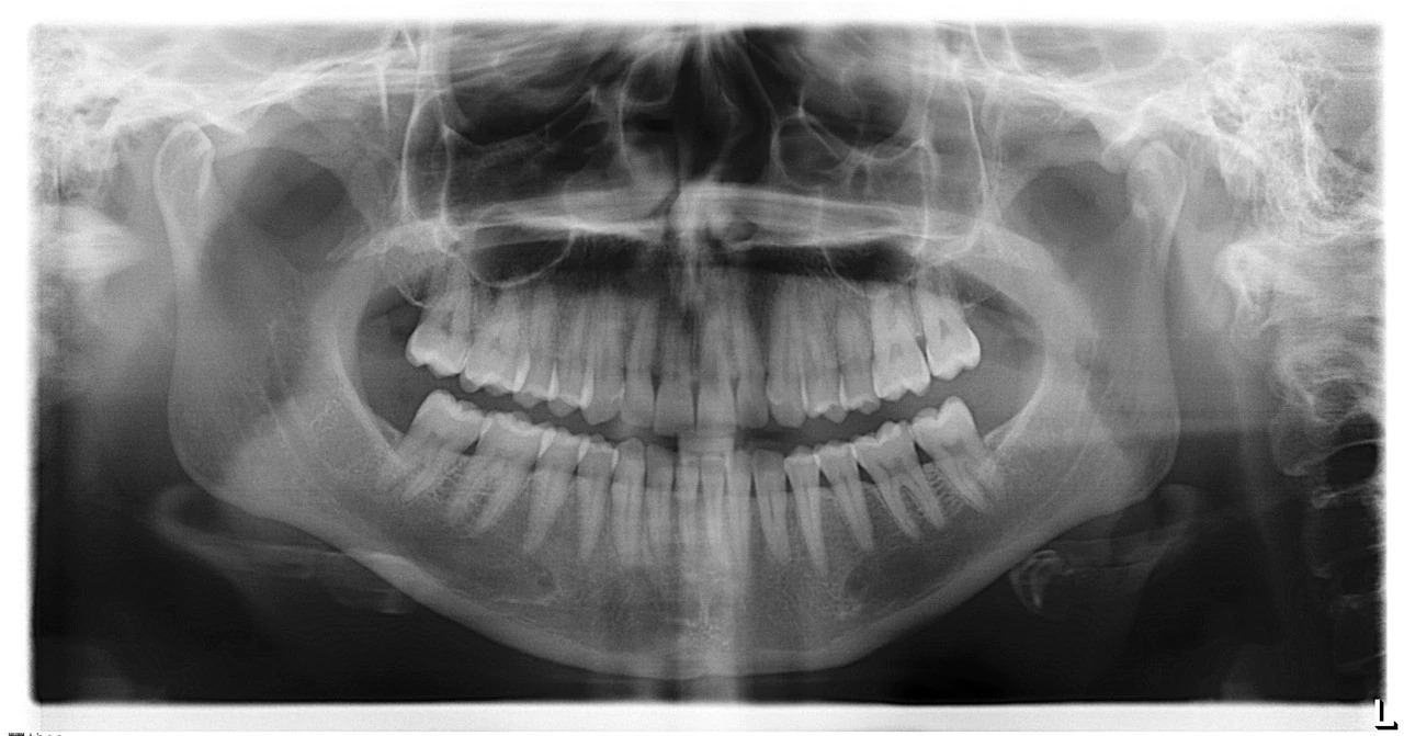 西诺德口腔全景机维修,西诺德口腔ct机