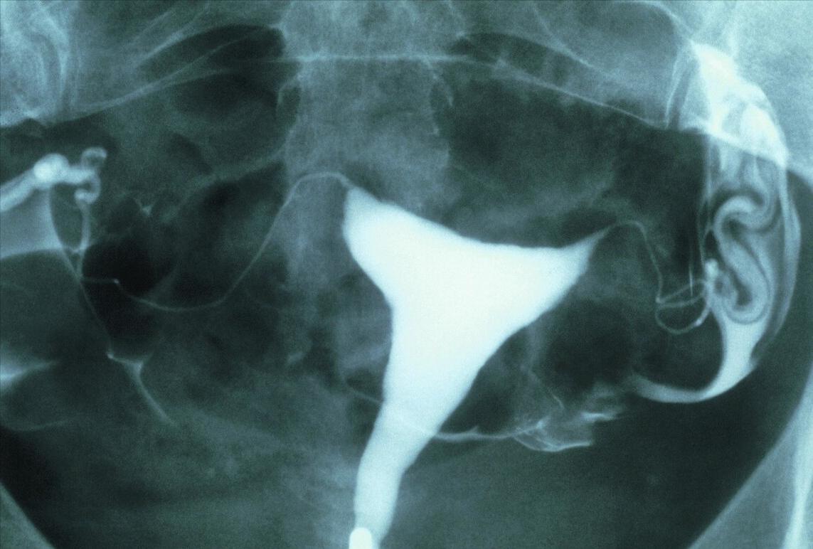 派特灵生物治疗靠谱吗,派特生物治疗视频
