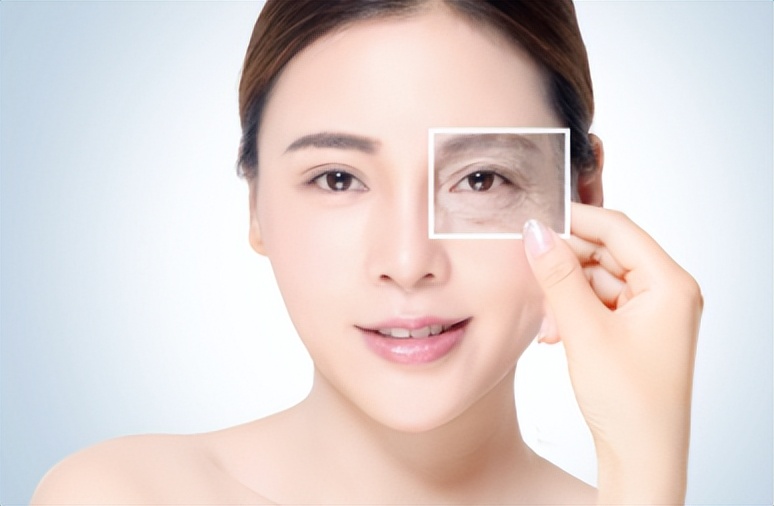 解决鱼尾纹最好的办法,教你一招如何淡化鱼尾纹