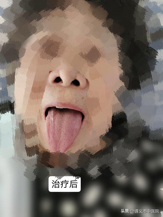 易生病体质怎么调,易感体质可以中医调理吗