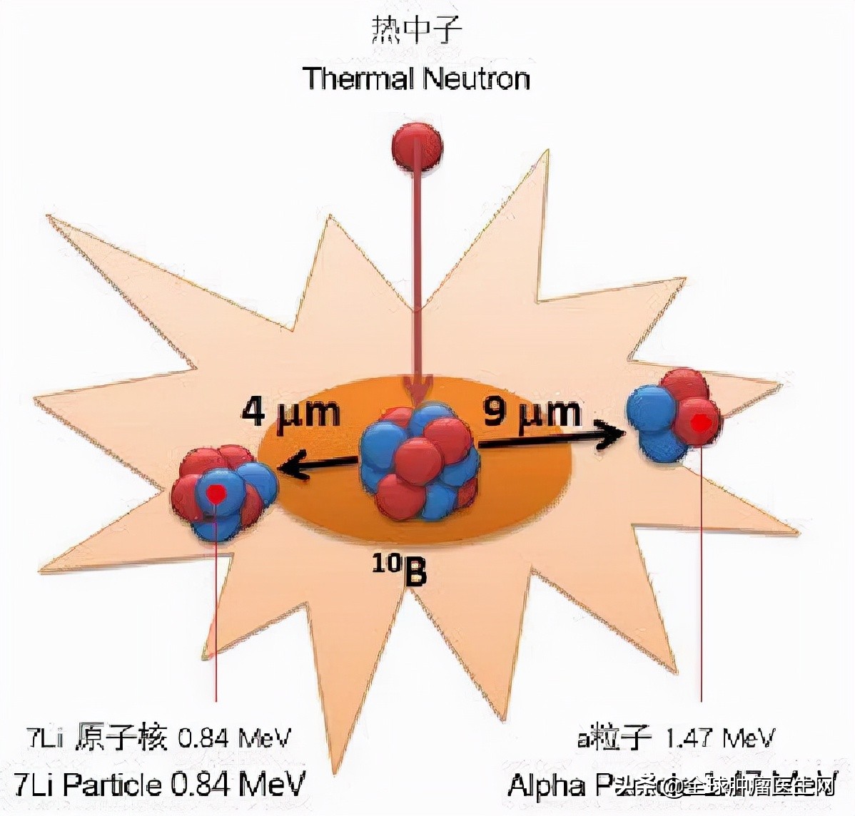 硼中子俘获治疗国内最新进展,国内首台硼中子俘获治疗装置下线