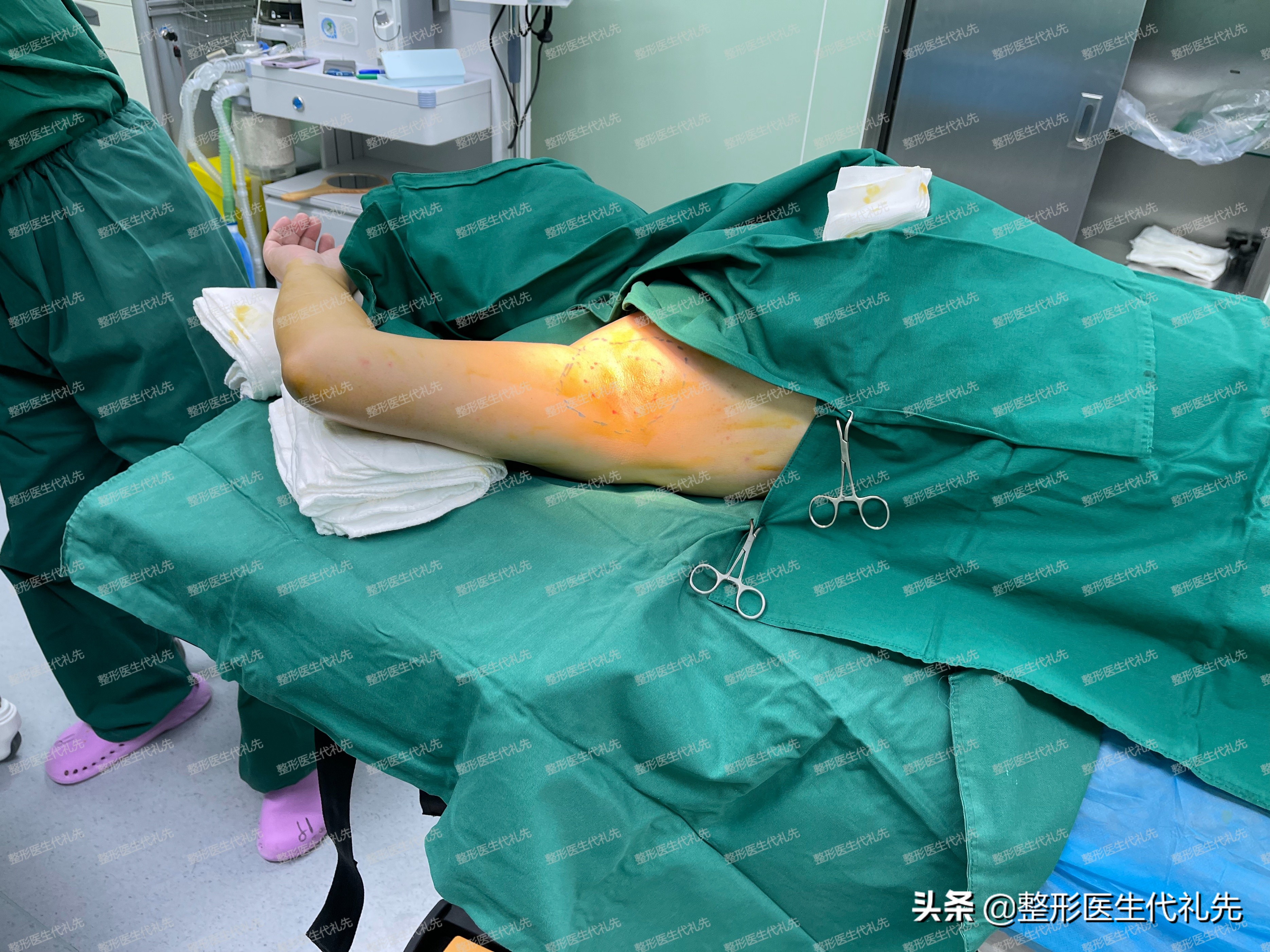 腋臭的较佳治疗方法及价格,腋臭的最佳治疗方法一问一答