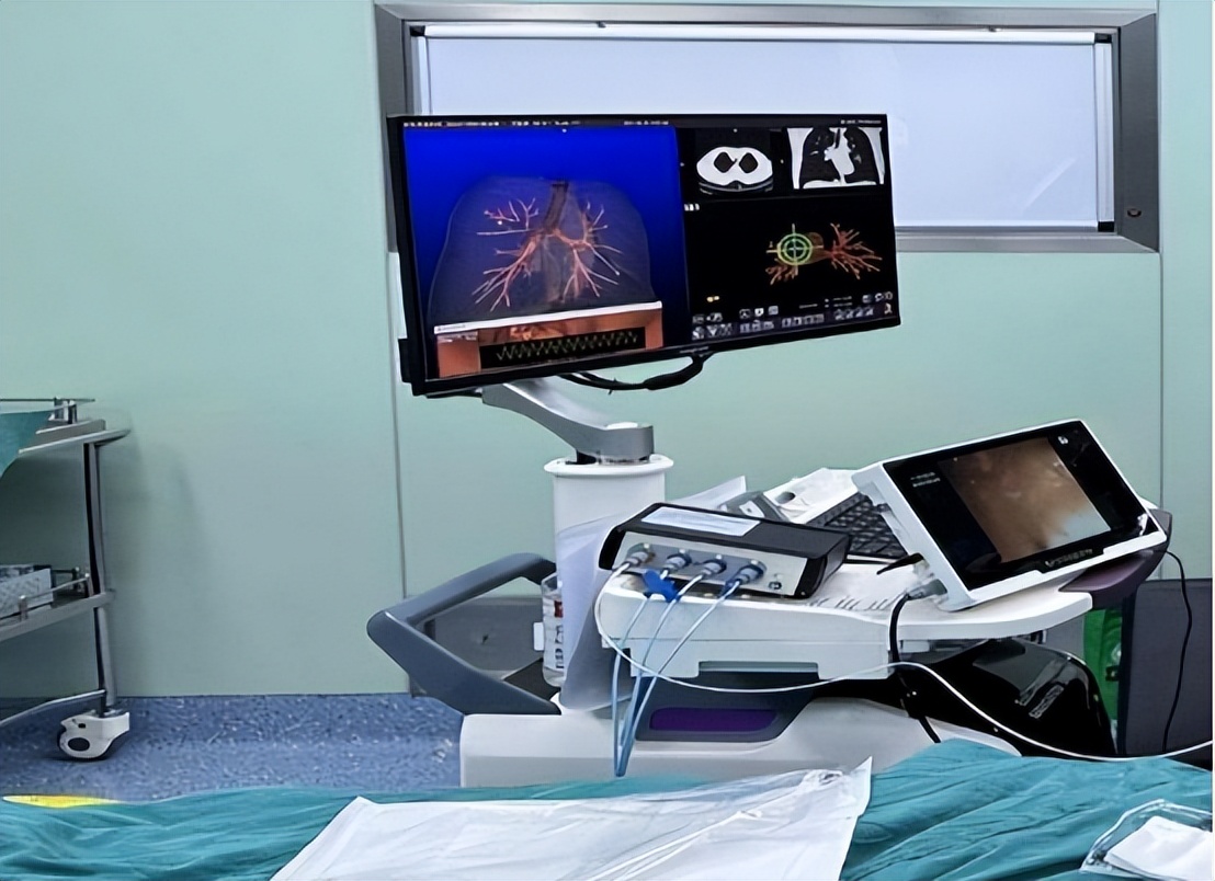 胸腔镜下胸膜冷冻活检，在胸腔积液诊断中，有价值和安全性么