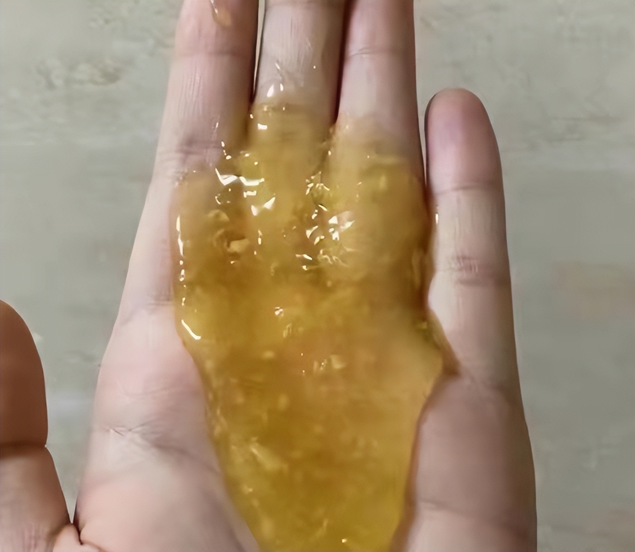 脱发人士必看超好用的生发方法,脱发的朋友注意了生发方法在这里