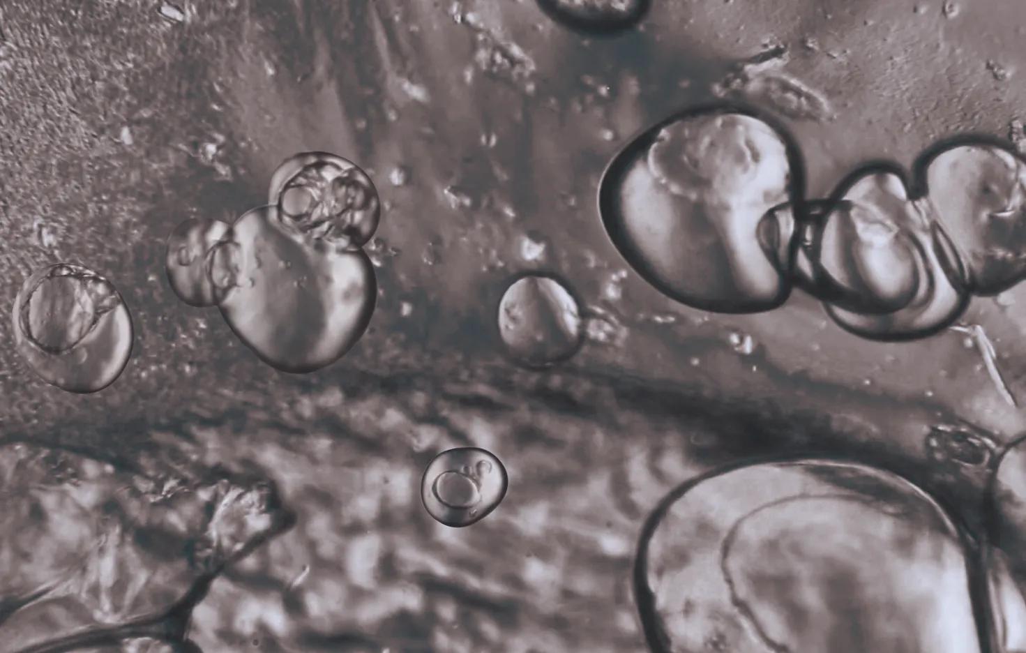 口服玻尿酸对皮肤有好处吗,口服玻尿酸增强皮肤弹性