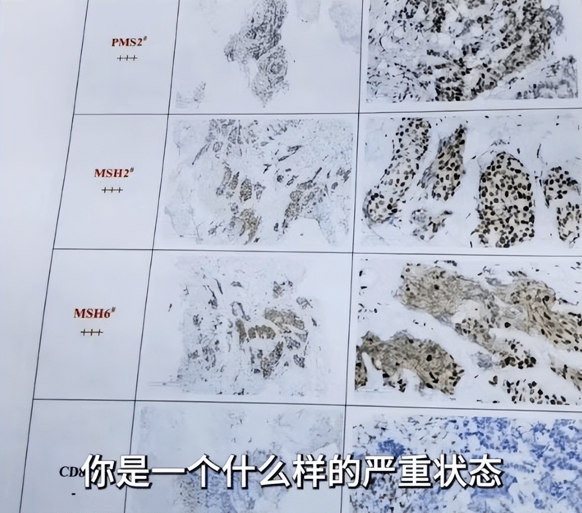 财经女侠叶檀完整视频,叶檀谈自己患乳腺癌几期