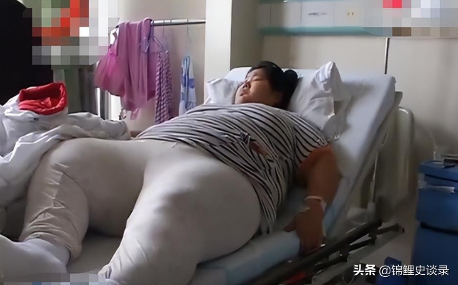 罕见260斤孕妇安徽,260斤巨婴孕妇