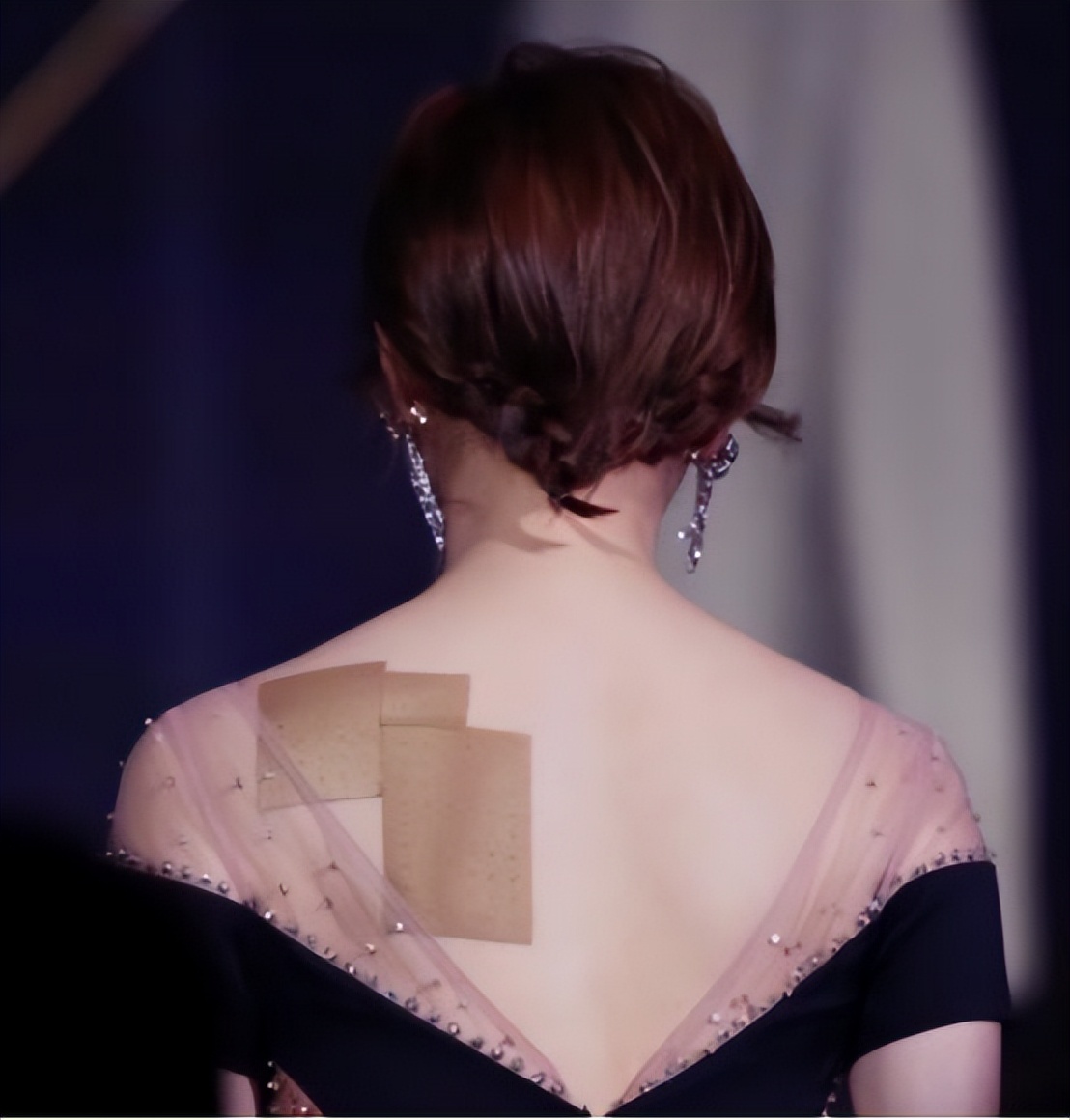 全球唯一可以治愈骨关节炎的药物,骨关节炎特效药最新研究