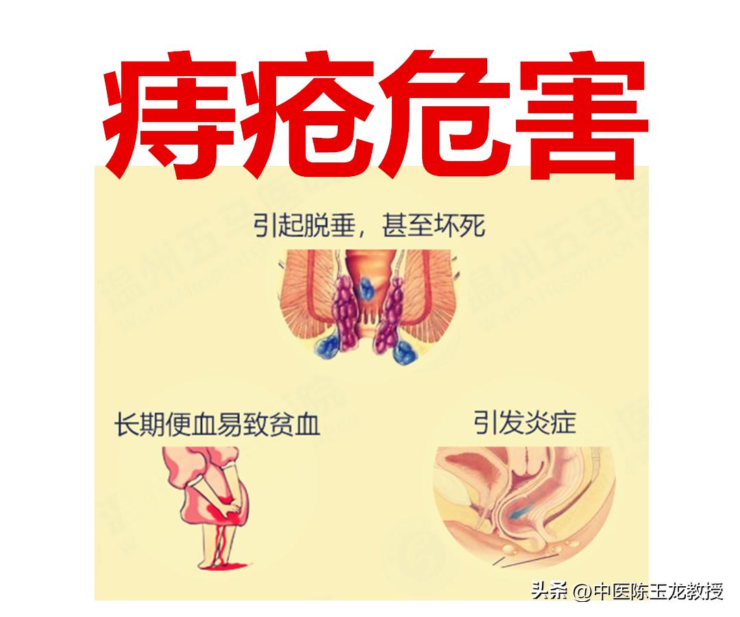 马应龙痔疮膏可以根治痔疮么,马应龙痔疮膏能根治痔疮吗