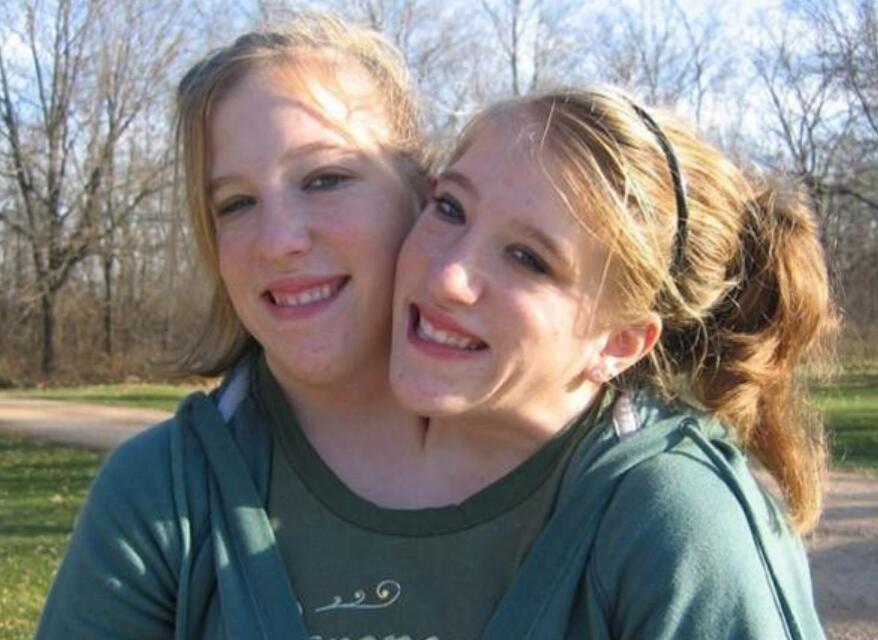 连体人该怎么结婚生子,邦克兄弟连体人