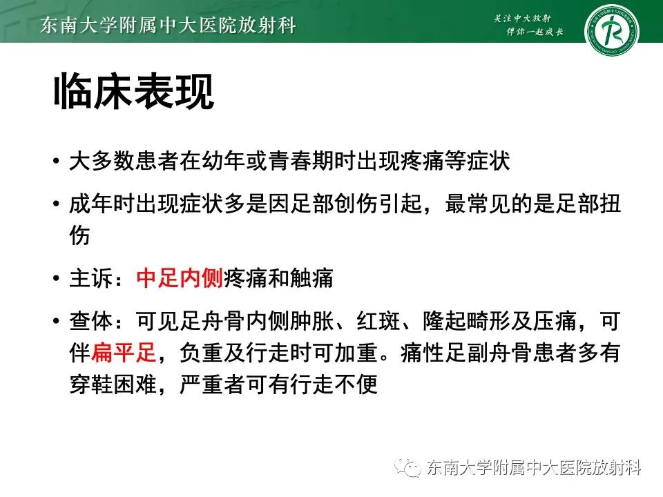 好文分享-《肌骨系统疾病——副舟骨综合征》