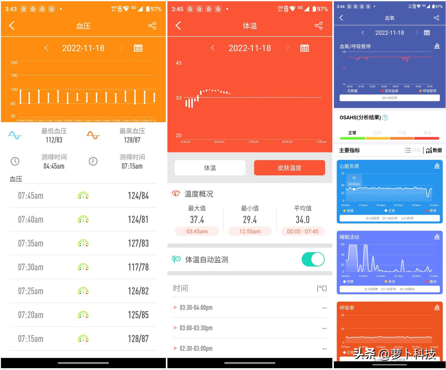 血压血糖测试多少钱,血糖血压心电图检查多少钱